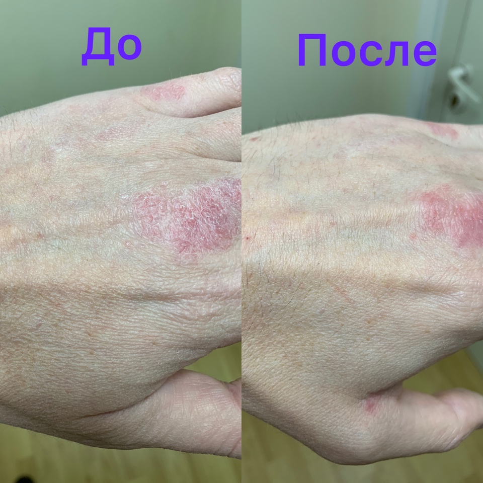 slim you код на скидку
