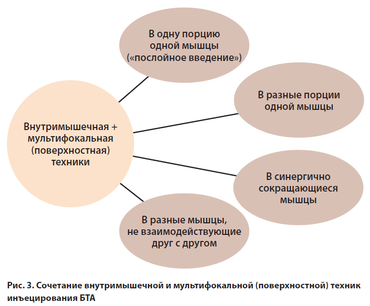 через какое время действует релатокс. Смотреть фото через какое время действует релатокс. Смотреть картинку через какое время действует релатокс. Картинка про через какое время действует релатокс. Фото через какое время действует релатокс