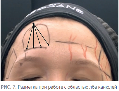 Как называется место под глазами. mceclip4 1621520483083. Как называется место под глазами фото. Как называется место под глазами-mceclip4 1621520483083. картинка Как называется место под глазами. картинка mceclip4 1621520483083