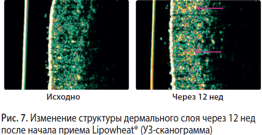 липидный баланс кожи это что. Смотреть фото липидный баланс кожи это что. Смотреть картинку липидный баланс кожи это что. Картинка про липидный баланс кожи это что. Фото липидный баланс кожи это что