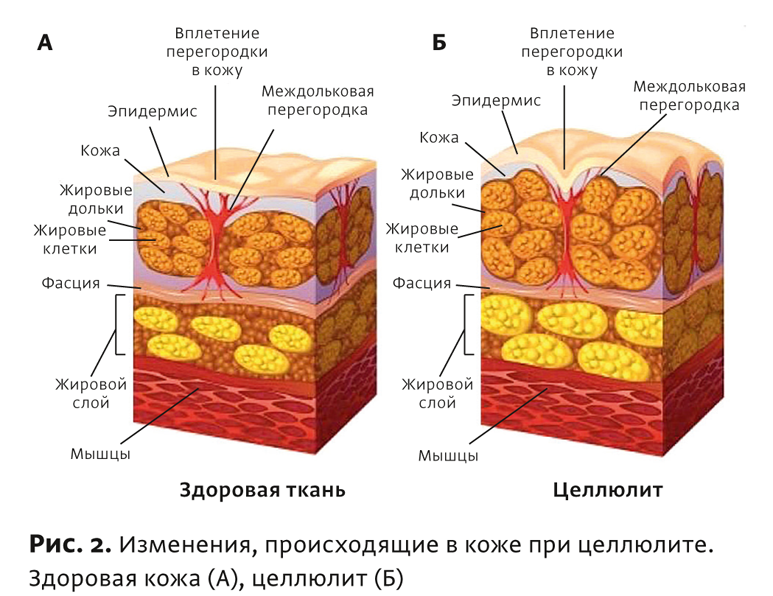 Физиотерапия бтл что это. Смотреть фото Физиотерапия бтл что это. Смотреть картинку Физиотерапия бтл что это. Картинка про Физиотерапия бтл что это. Фото Физиотерапия бтл что это