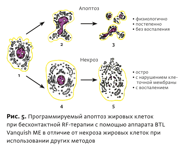 Физиотерапия бтл что это. Смотреть фото Физиотерапия бтл что это. Смотреть картинку Физиотерапия бтл что это. Картинка про Физиотерапия бтл что это. Фото Физиотерапия бтл что это