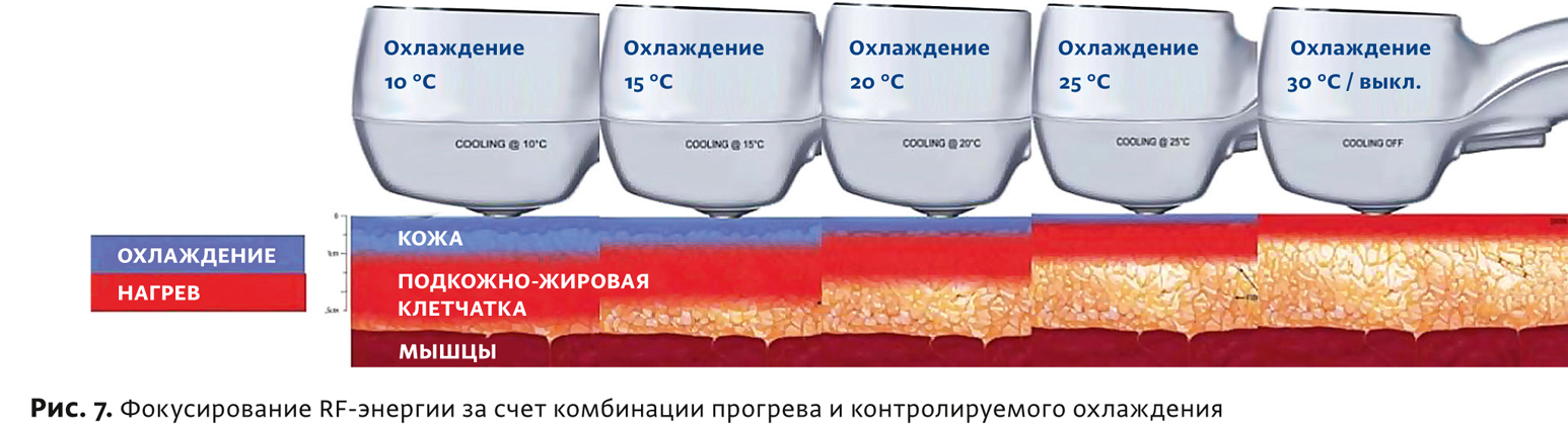 Физиотерапия бтл что это. Смотреть фото Физиотерапия бтл что это. Смотреть картинку Физиотерапия бтл что это. Картинка про Физиотерапия бтл что это. Фото Физиотерапия бтл что это