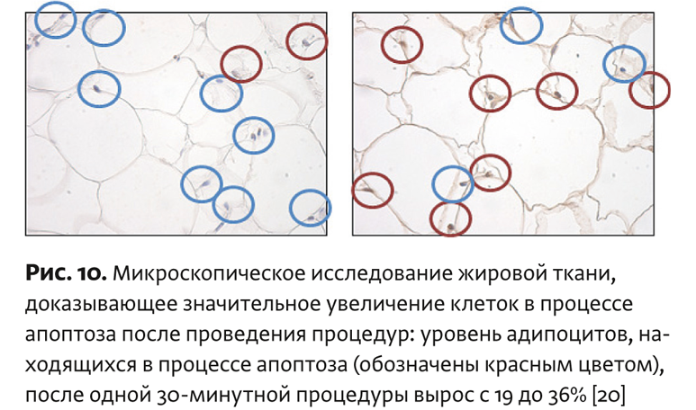 Физиотерапия бтл что это. Смотреть фото Физиотерапия бтл что это. Смотреть картинку Физиотерапия бтл что это. Картинка про Физиотерапия бтл что это. Фото Физиотерапия бтл что это
