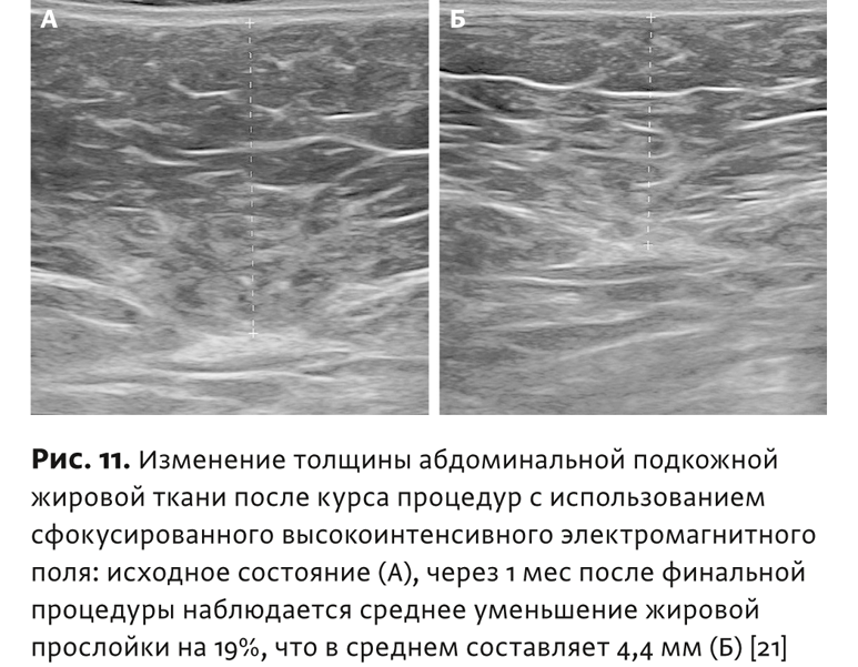 Физиотерапия бтл что это. Смотреть фото Физиотерапия бтл что это. Смотреть картинку Физиотерапия бтл что это. Картинка про Физиотерапия бтл что это. Фото Физиотерапия бтл что это