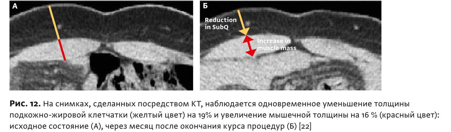 Физиотерапия бтл что это. Смотреть фото Физиотерапия бтл что это. Смотреть картинку Физиотерапия бтл что это. Картинка про Физиотерапия бтл что это. Фото Физиотерапия бтл что это