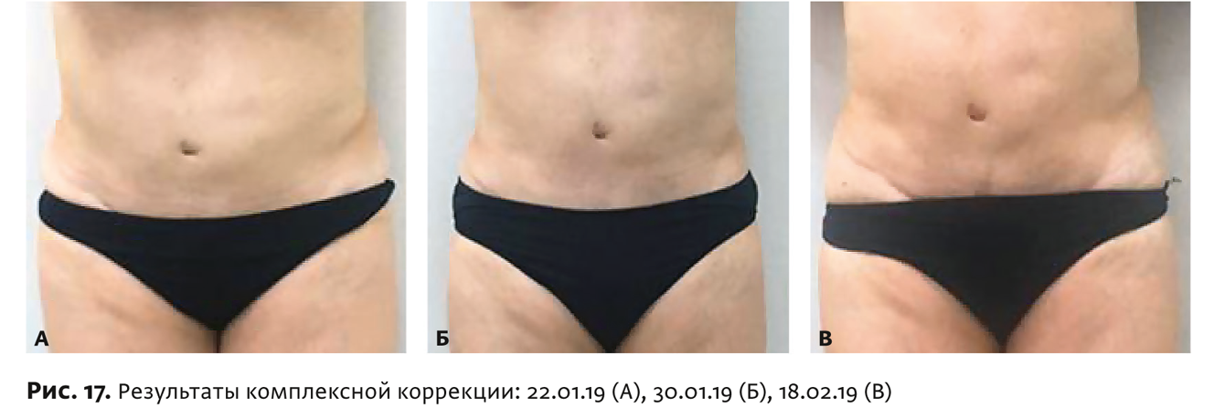 Физиотерапия бтл что это. Смотреть фото Физиотерапия бтл что это. Смотреть картинку Физиотерапия бтл что это. Картинка про Физиотерапия бтл что это. Фото Физиотерапия бтл что это