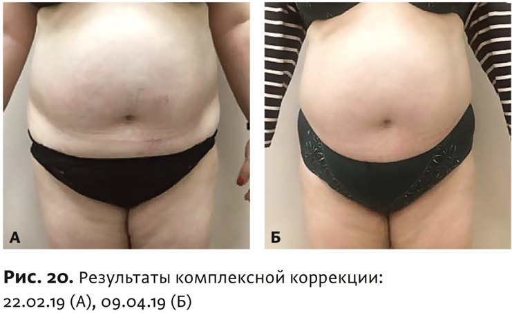 Физиотерапия бтл что это. Смотреть фото Физиотерапия бтл что это. Смотреть картинку Физиотерапия бтл что это. Картинка про Физиотерапия бтл что это. Фото Физиотерапия бтл что это