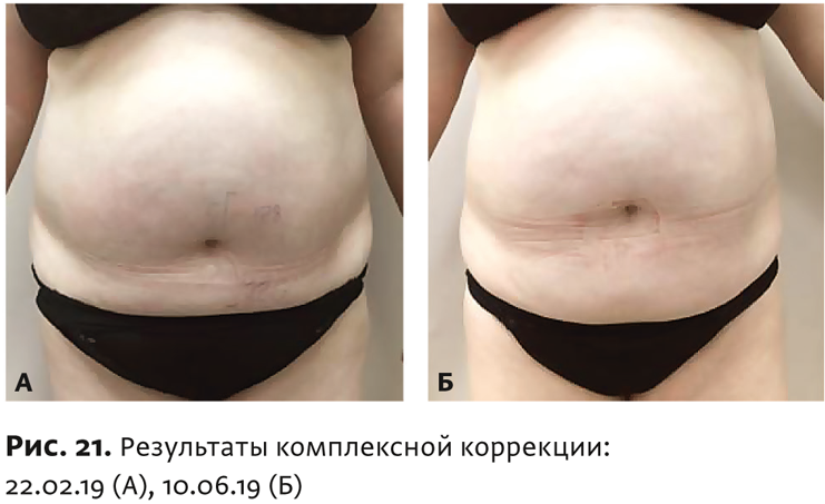 Физиотерапия бтл что это. Смотреть фото Физиотерапия бтл что это. Смотреть картинку Физиотерапия бтл что это. Картинка про Физиотерапия бтл что это. Фото Физиотерапия бтл что это