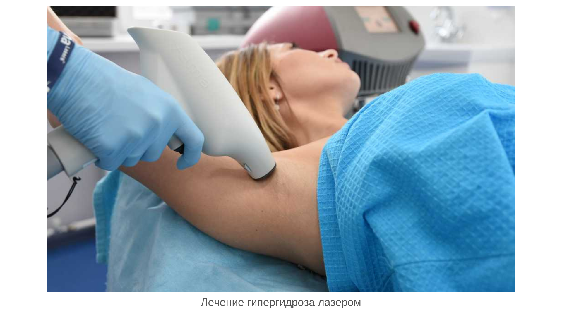 какие таблетки надо пить чтобы не потеть. Смотреть фото какие таблетки надо пить чтобы не потеть. Смотреть картинку какие таблетки надо пить чтобы не потеть. Картинка про какие таблетки надо пить чтобы не потеть. Фото какие таблетки надо пить чтобы не потеть