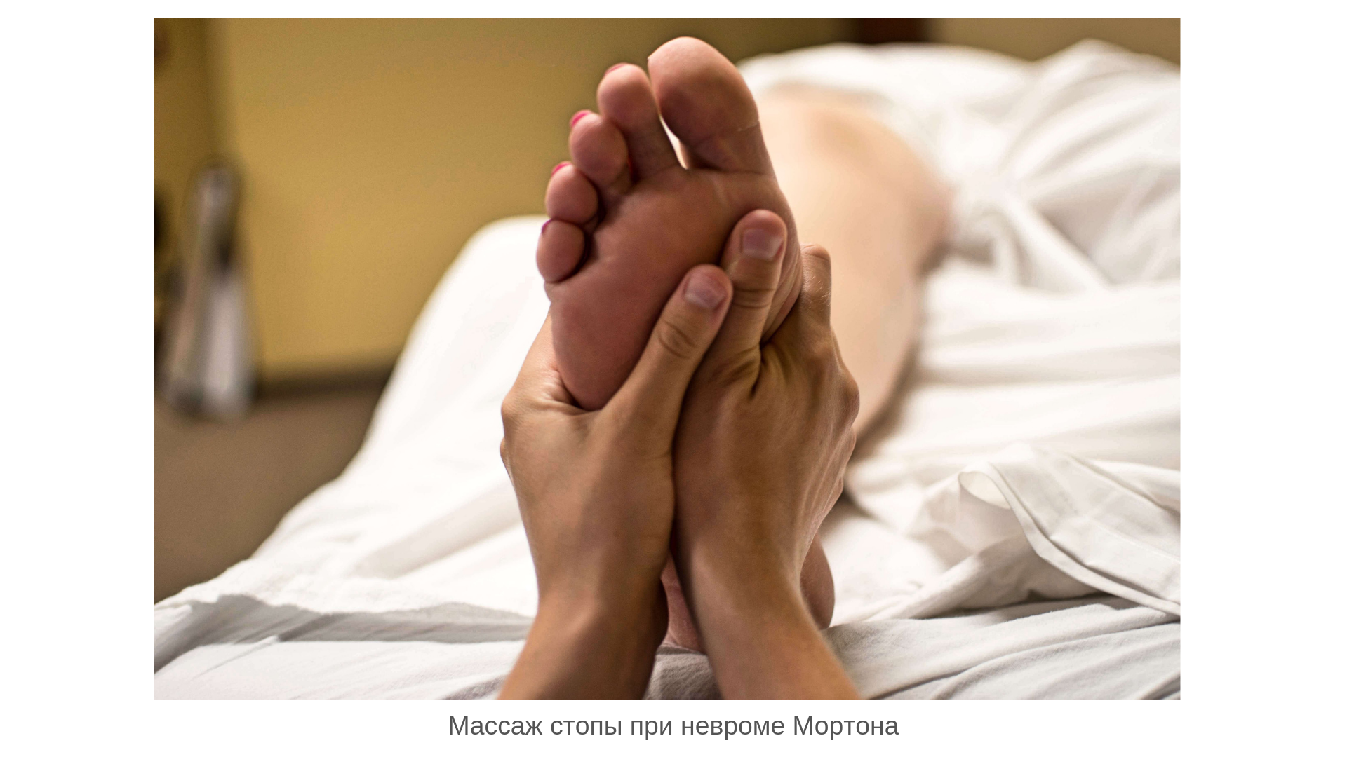 Мортона неврома мортона что это такое. Смотреть фото Мортона неврома мортона что это такое. Смотреть картинку Мортона неврома мортона что это такое. Картинка про Мортона неврома мортона что это такое. Фото Мортона неврома мортона что это такое