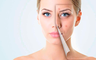 Прыщ на носу: профилактика и лечение