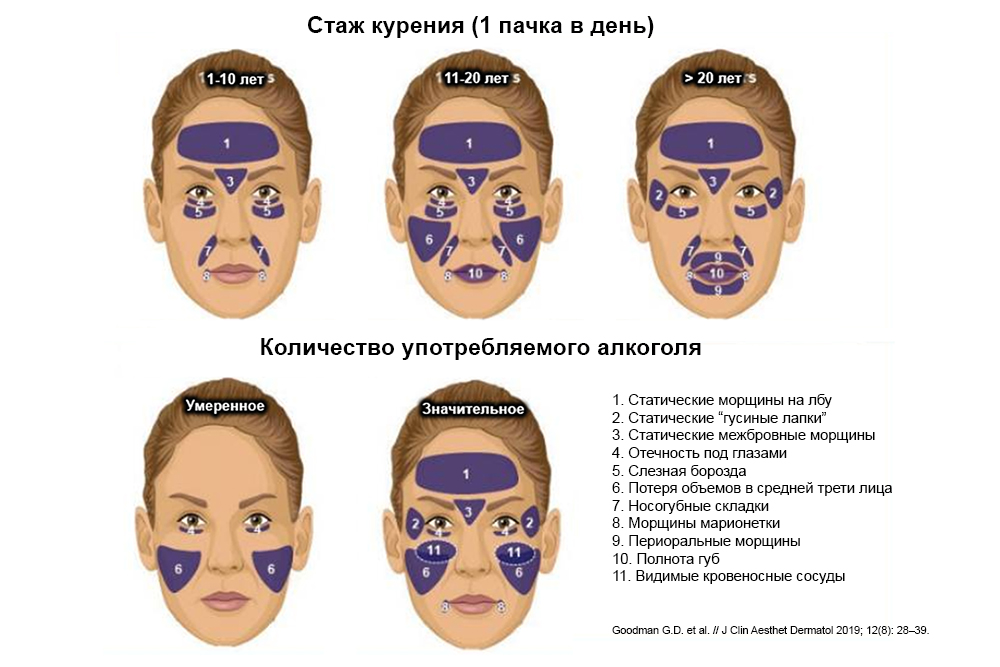 Kurenie I Alkogol Naglyadnyj Vklad V Starenie Kozhi