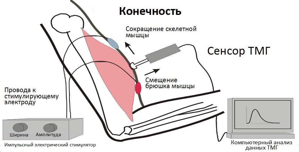 что такое тмг в медицине. Смотреть фото что такое тмг в медицине. Смотреть картинку что такое тмг в медицине. Картинка про что такое тмг в медицине. Фото что такое тмг в медицине