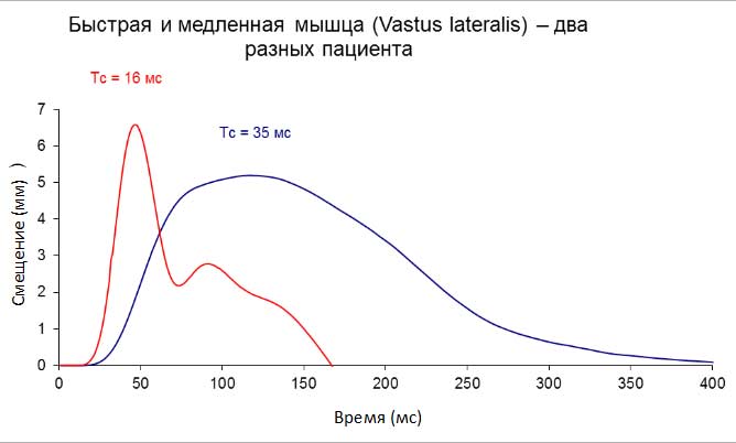 что такое тмг в медицине. Смотреть фото что такое тмг в медицине. Смотреть картинку что такое тмг в медицине. Картинка про что такое тмг в медицине. Фото что такое тмг в медицине