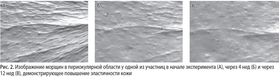 Фотопротекторное действие что это значит. Смотреть фото Фотопротекторное действие что это значит. Смотреть картинку Фотопротекторное действие что это значит. Картинка про Фотопротекторное действие что это значит. Фото Фотопротекторное действие что это значит