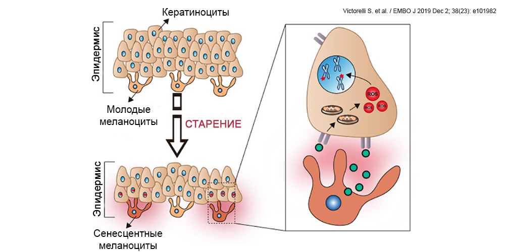 меланоциты что это аномальные. Смотреть фото меланоциты что это аномальные. Смотреть картинку меланоциты что это аномальные. Картинка про меланоциты что это аномальные. Фото меланоциты что это аномальные