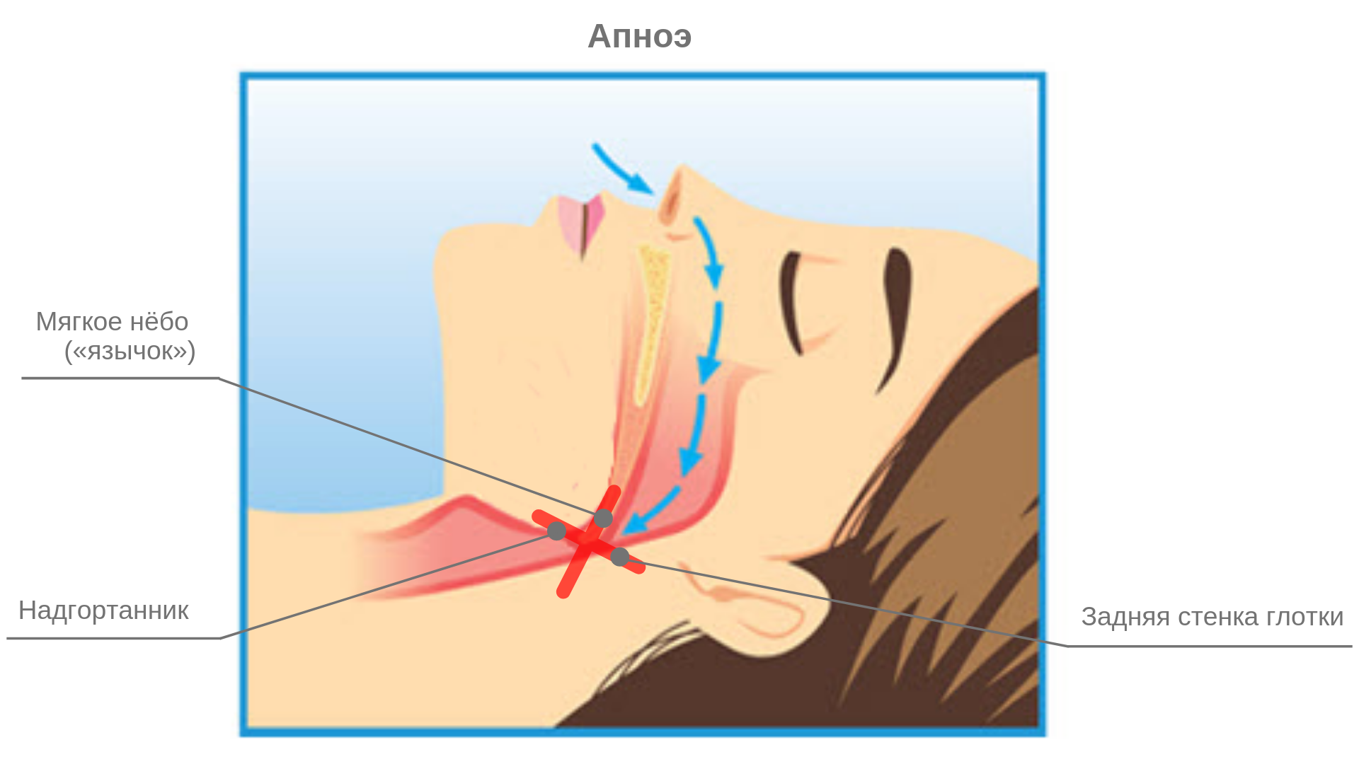 Дышать носом когда спишь. Механизм формирования апноэ сна.