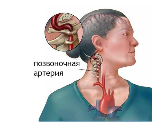 гимнастика доктора шишонина для шеи спасла уже очень многих людей поможет и вам. Смотреть фото гимнастика доктора шишонина для шеи спасла уже очень многих людей поможет и вам. Смотреть картинку гимнастика доктора шишонина для шеи спасла уже очень многих людей поможет и вам. Картинка про гимнастика доктора шишонина для шеи спасла уже очень многих людей поможет и вам. Фото гимнастика доктора шишонина для шеи спасла уже очень многих людей поможет и вам