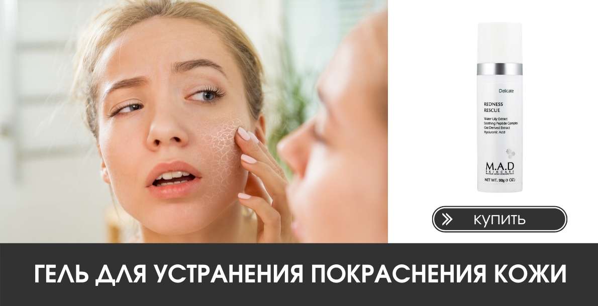 Нарушение сна с покраснением лица. %D0%A3%D0%A5%D0%9E%D0%94 %D0%97%D0%90 %D0%93%D0%A3%D0%91%D0%90%D0%9C%D0%98 %D0%BA%D0%BE%D0%BF%D0%B8%D1%8F 7. Нарушение сна с покраснением лица фото. Нарушение сна с покраснением лица-%D0%A3%D0%A5%D0%9E%D0%94 %D0%97%D0%90 %D0%93%D0%A3%D0%91%D0%90%D0%9C%D0%98 %D0%BA%D0%BE%D0%BF%D0%B8%D1%8F 7. картинка Нарушение сна с покраснением лица. картинка %D0%A3%D0%A5%D0%9E%D0%94 %D0%97%D0%90 %D0%93%D0%A3%D0%91%D0%90%D0%9C%D0%98 %D0%BA%D0%BE%D0%BF%D0%B8%D1%8F 7. Работа человеческого организма, в том числе и кожи, подчинена определенным биоритмам. Однако темп современной жизни и ненормированный график все чаще лишают нас сна.