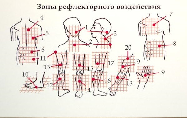 аппликатор кузнецова зоны воздействия